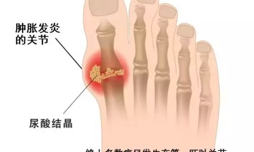 病人猝死在公司场地谁负责-病人猝死在公司场地网 - 为你提供猝死在岗位上会赔钱吗、猝死在岗位上会赔钱吗